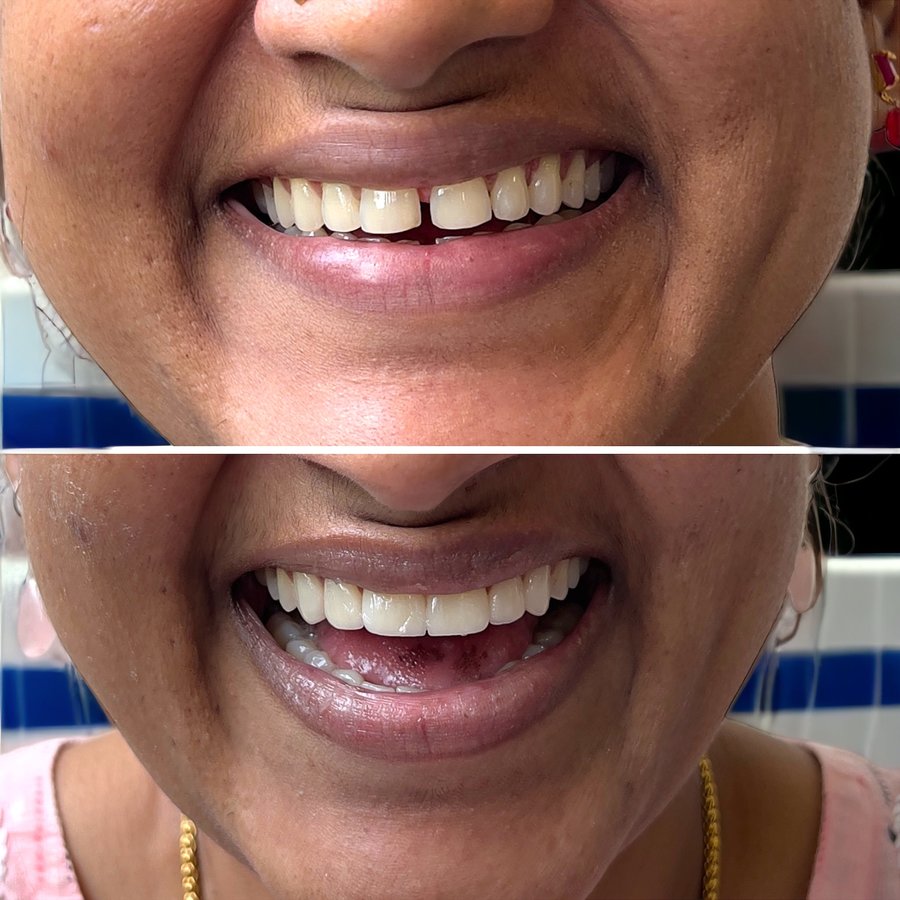 ألوكس لطب الأسنان - Alux Dental