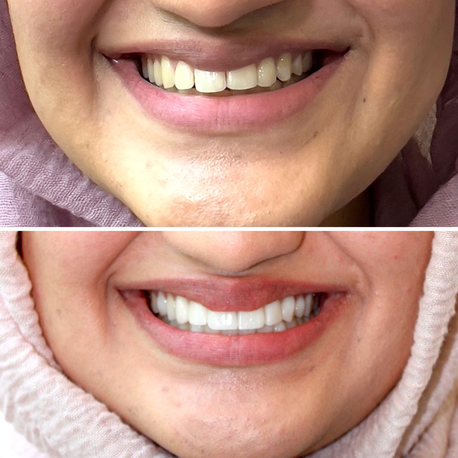ألوكس لطب الأسنان - Alux Dental
