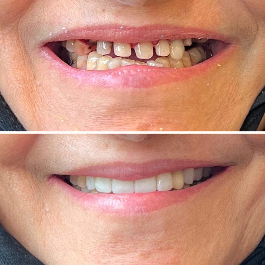 ألوكس لطب الأسنان - Alux Dental