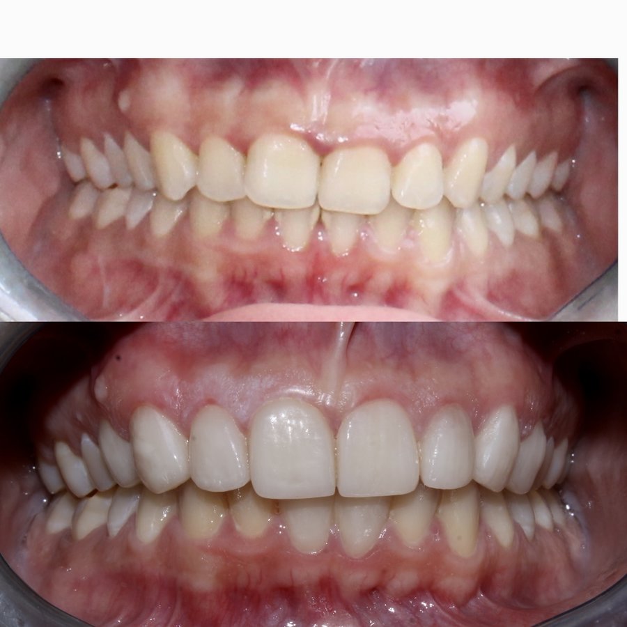 ألوكس لطب الأسنان - Alux Dental