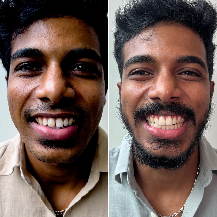 ألوكس لطب الأسنان - Alux Dental