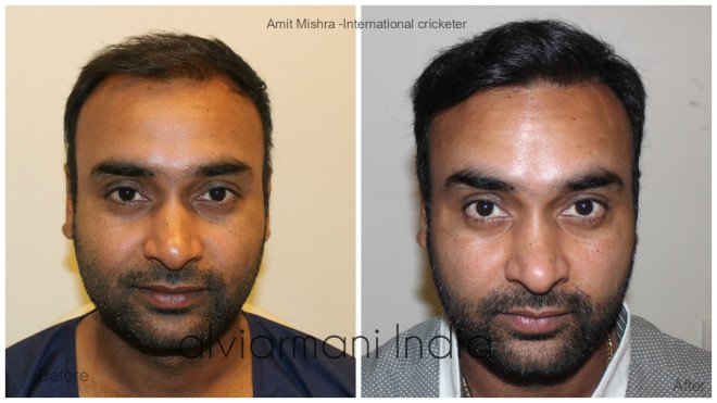 Alvi Armani - Alvi Armani