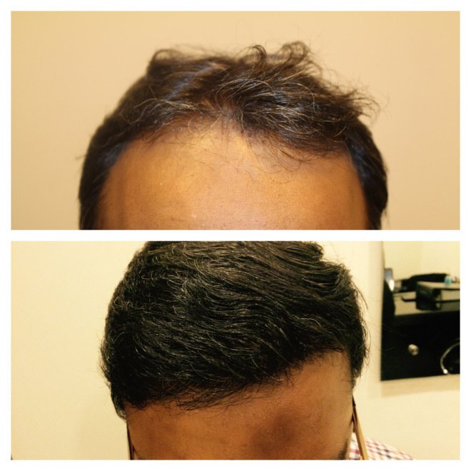 Alvi Armani - Alvi Armani