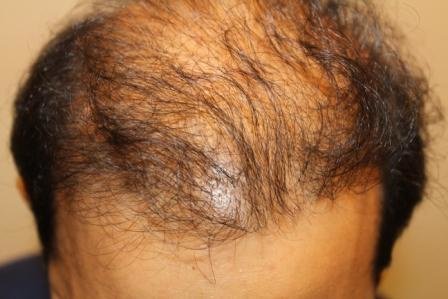 Alvi Armani - Alvi Armani