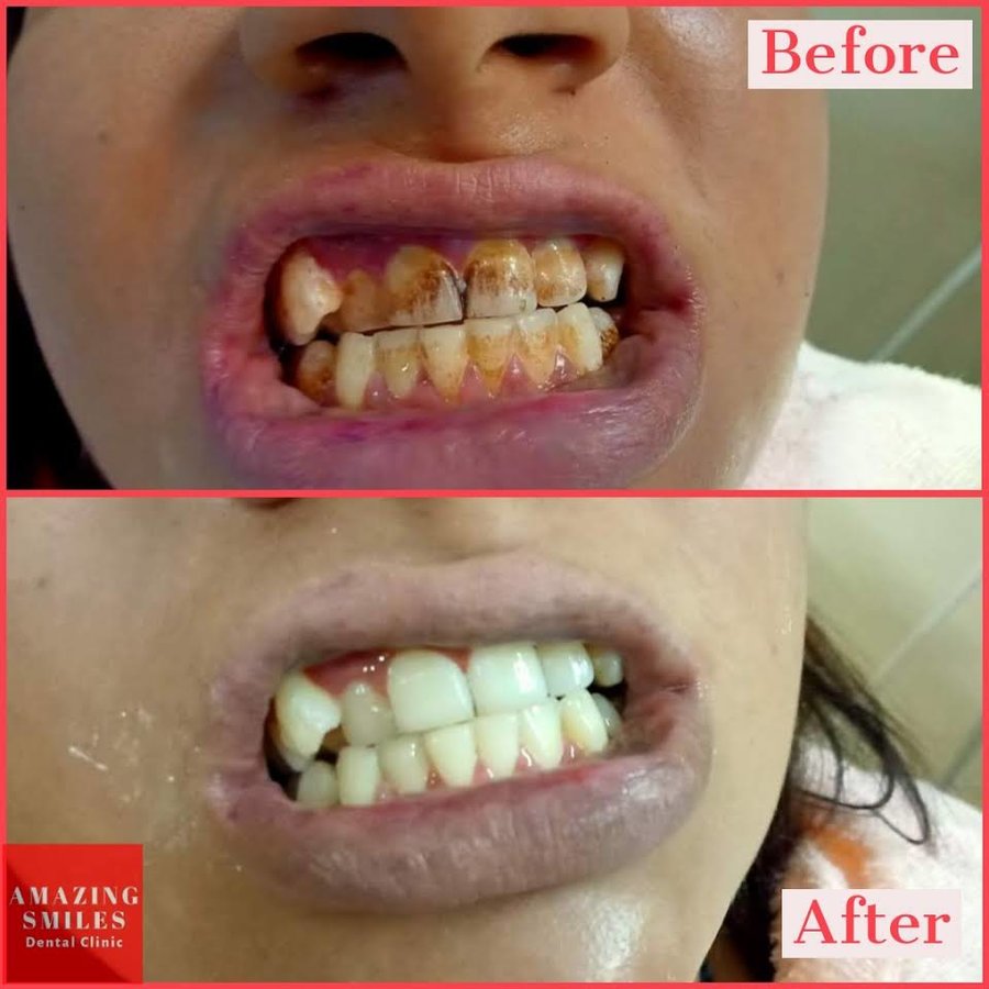 Amazing Smiles - Amazing Smiles