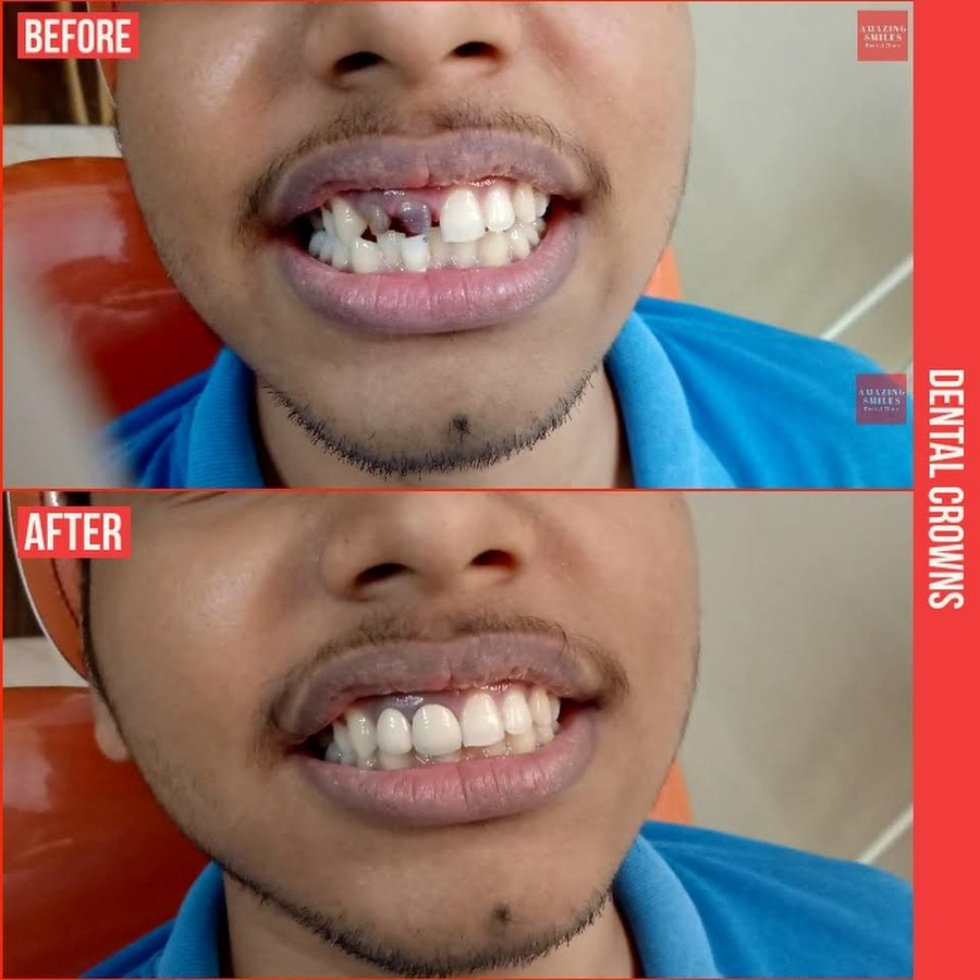 Amazing Smiles - Amazing Smiles