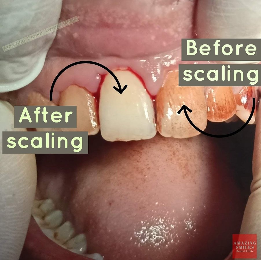 Amazing Smiles - Amazing Smiles