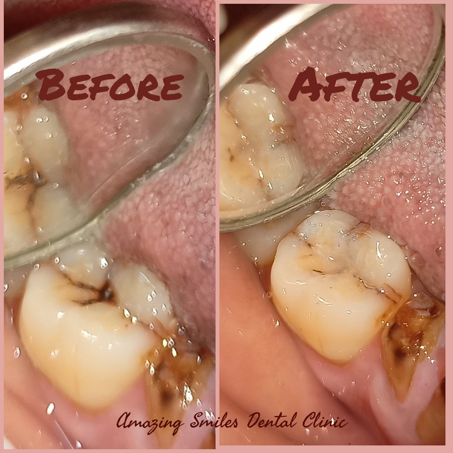 Amazing Smiles - Amazing Smiles