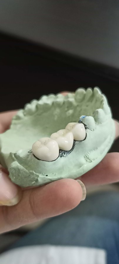 Amazing Smiles - Amazing Smiles