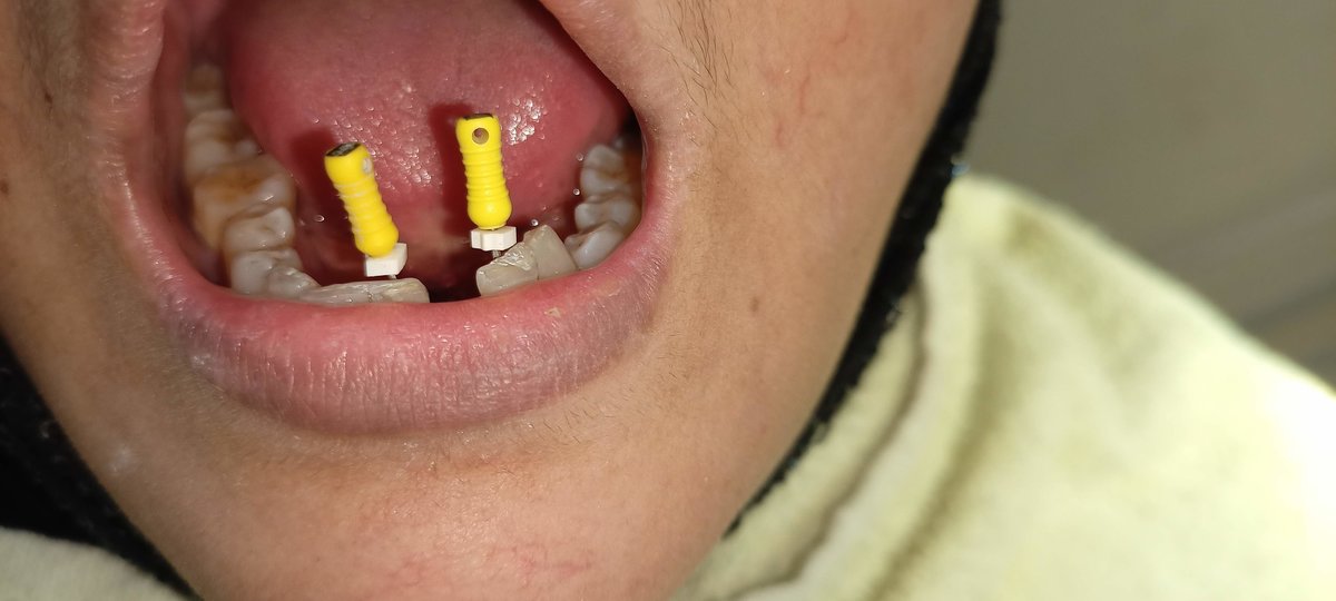 Amazing Smiles - Amazing Smiles