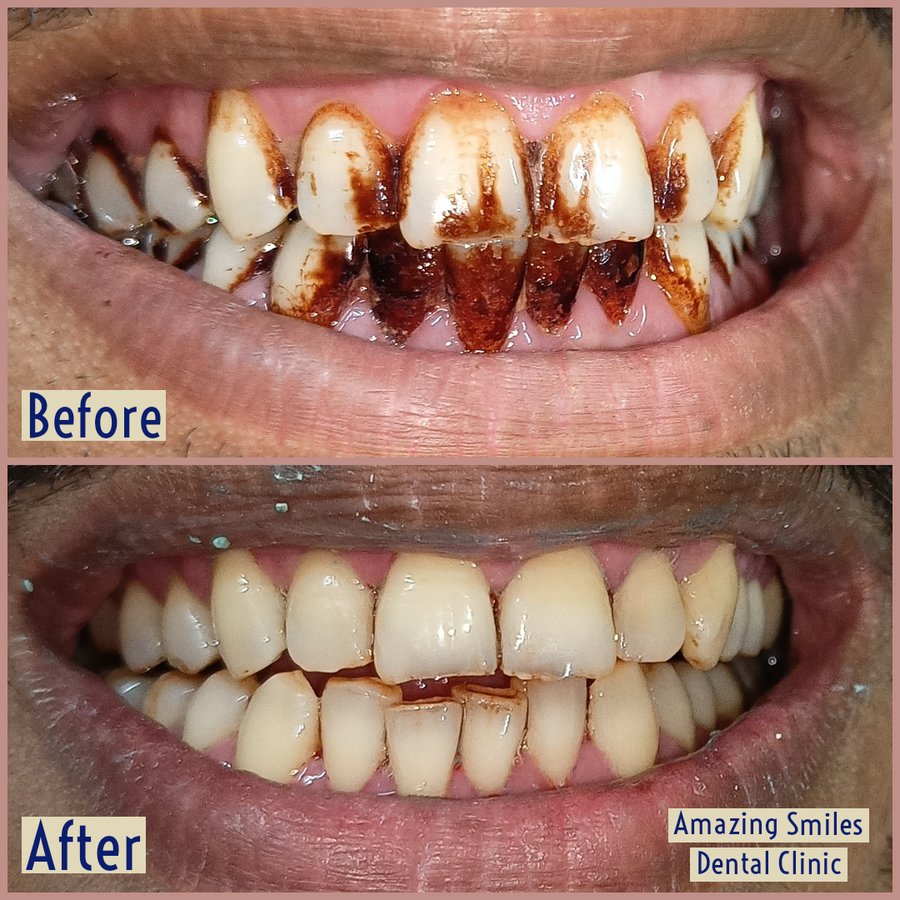 Amazing Smiles - Amazing Smiles