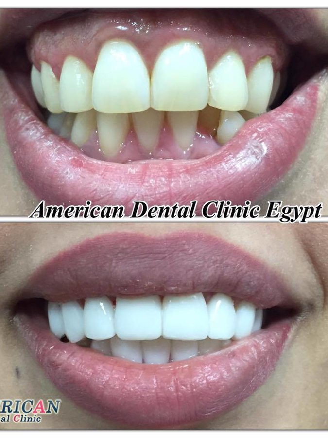 American Dental Clinic Egypt - American Dental Clinic Egypt
