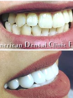American Dental Clinic Egypt - American Dental Clinic Egypt