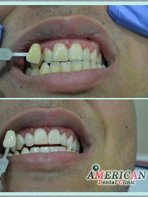 American Dental Clinic Egypt - American Dental Clinic Egypt