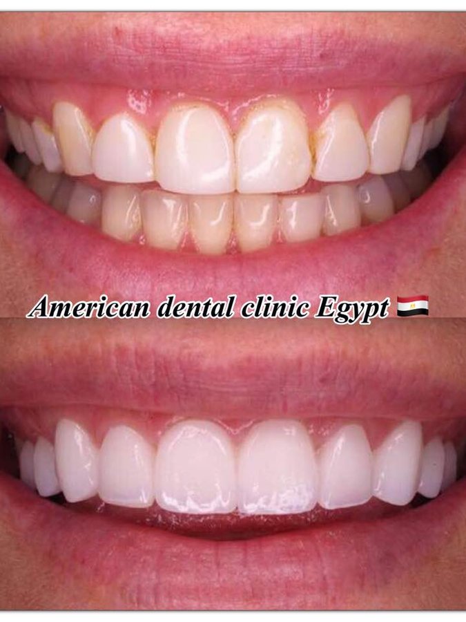 American Dental Clinic Egypt - American Dental Clinic Egypt