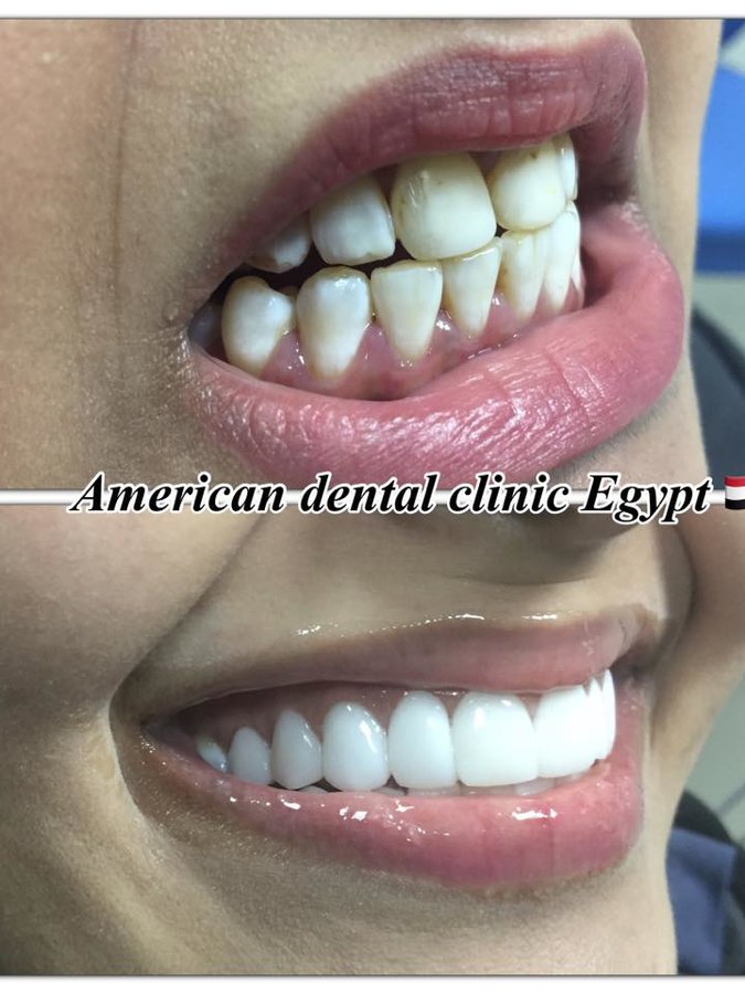 American Dental Clinic Egypt - American Dental Clinic Egypt