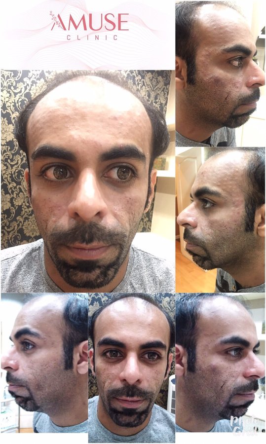 Amuse Clinic - Amuse Clinic