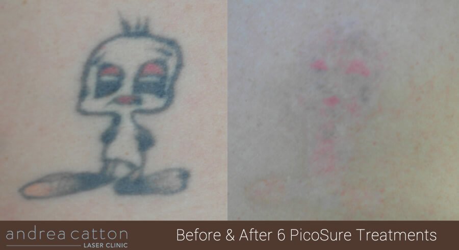 Andrea Catton Laser Clinic - Andrea Catton Laser Clinic