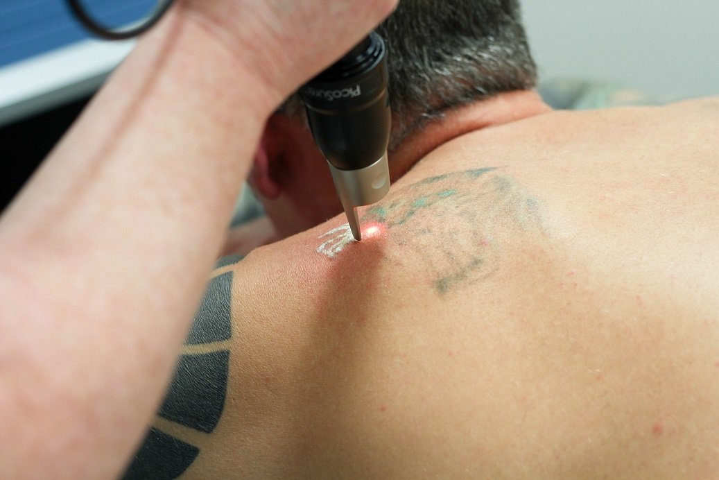 Andrea Catton Laser Clinic - Andrea Catton Laser Clinic