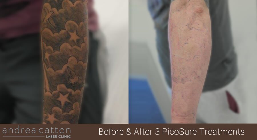 Andrea Catton Laser Clinic - Andrea Catton Laser Clinic