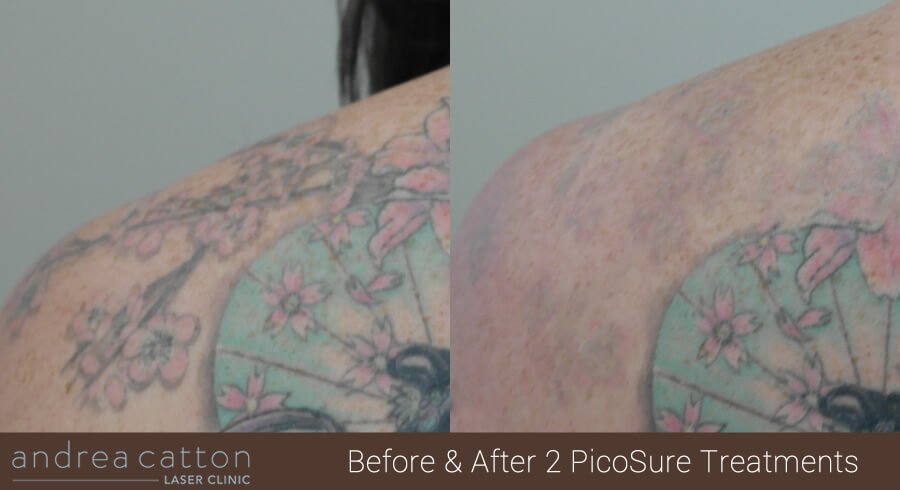 Andrea Catton Laser Clinic - Andrea Catton Laser Clinic