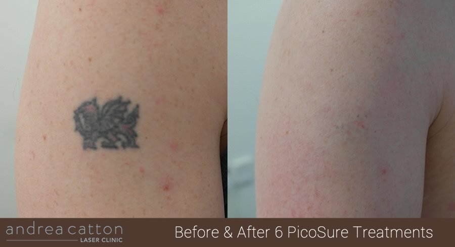 Andrea Catton Laser Clinic - Andrea Catton Laser Clinic