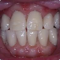 Andrews Denture Clinic - Andrews Denture Clinic