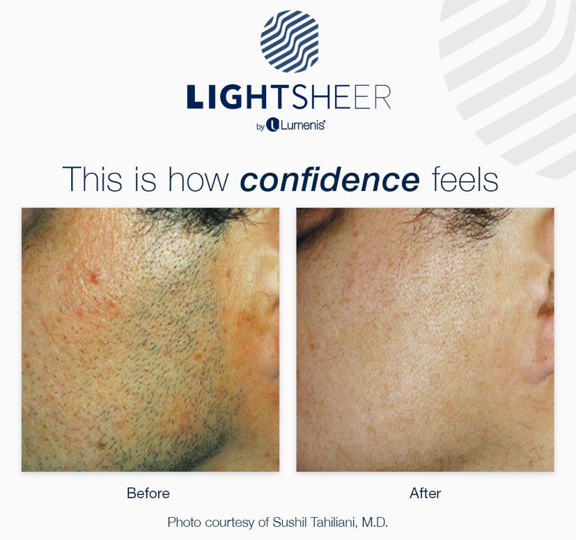 أنجا غوشا - Anja Gosha