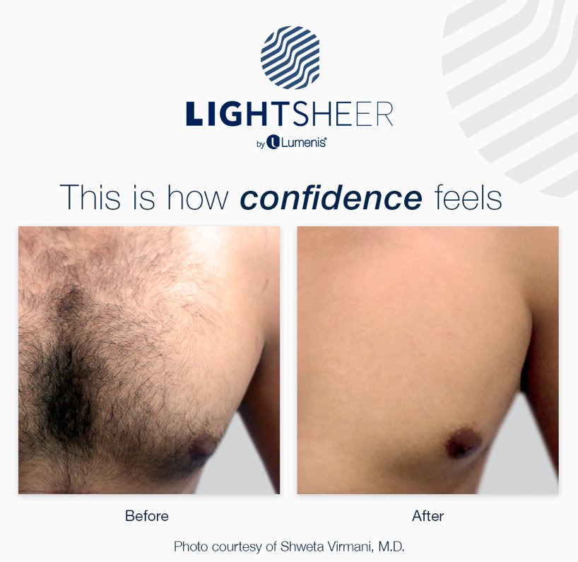 أنجا غوشا - Anja Gosha