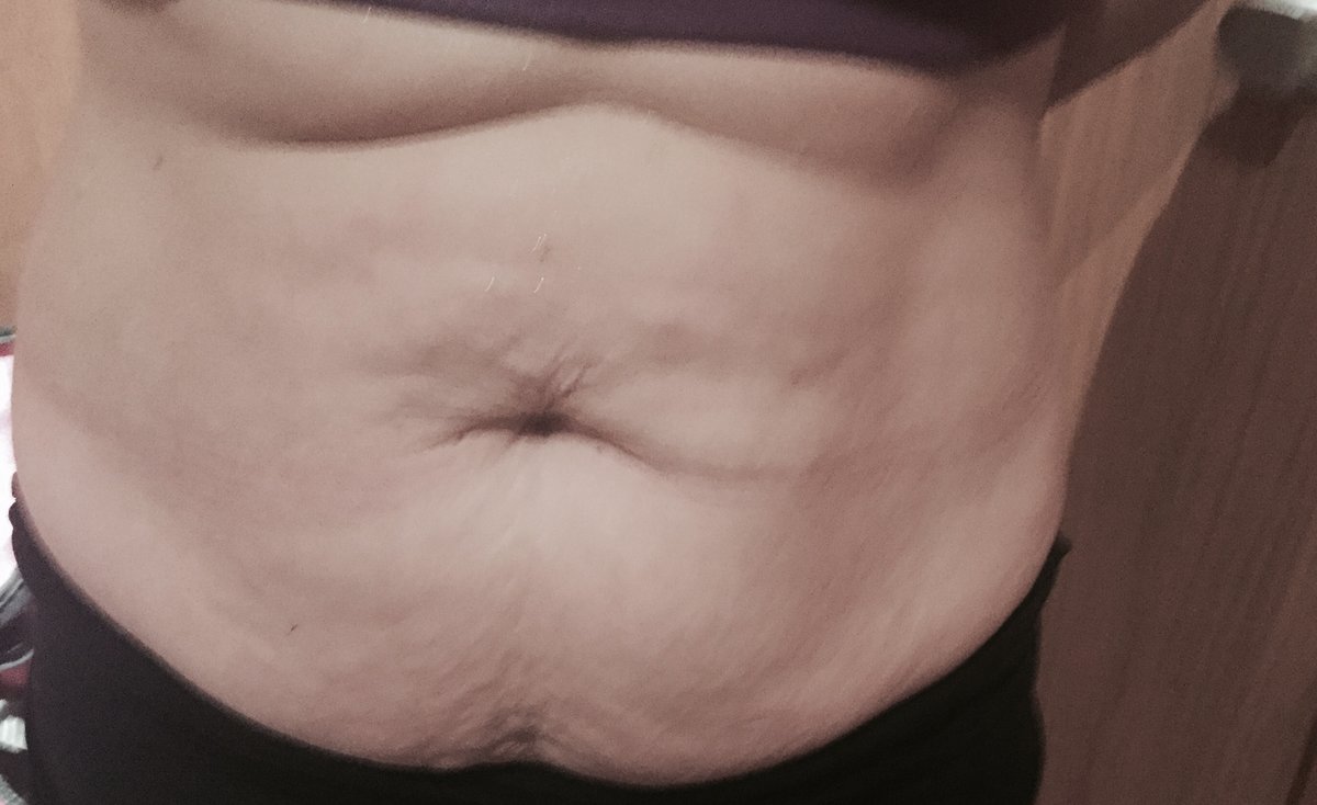 Anthony Barabas - Fenstanton Treatment centre - Anthony Barabas - Fenstanton Treatment centre