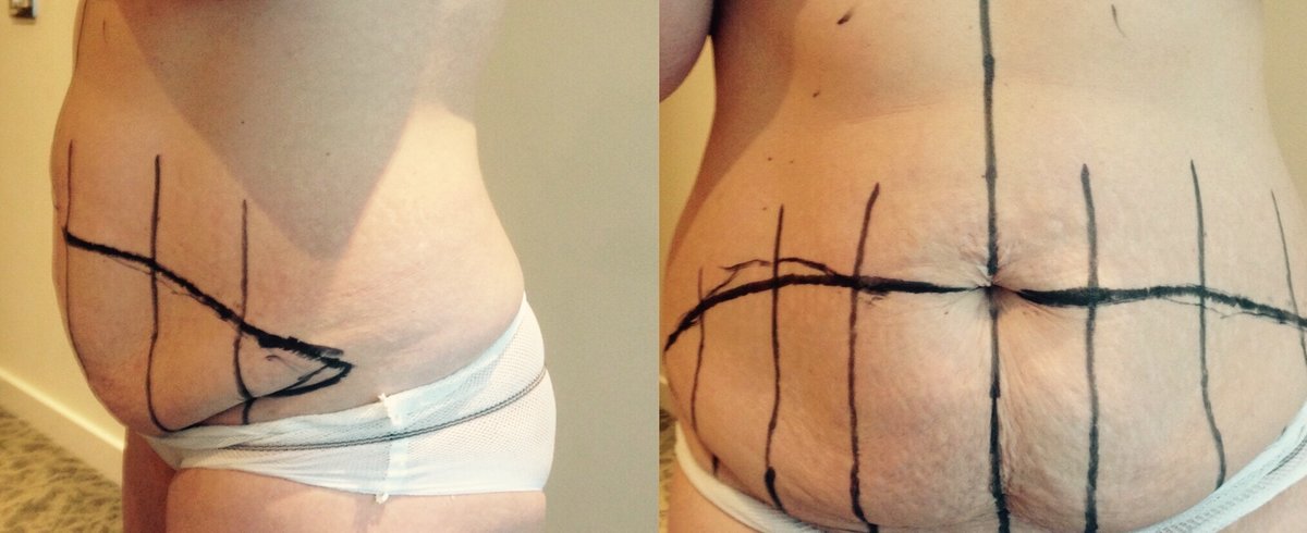 Anthony Barabas - Fenstanton Treatment centre - Anthony Barabas - Fenstanton Treatment centre