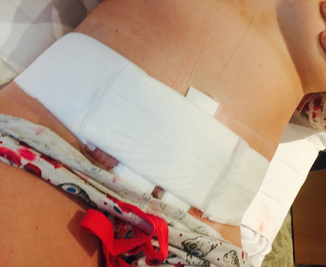 Anthony Barabas - Fenstanton Treatment centre - Anthony Barabas - Fenstanton Treatment centre