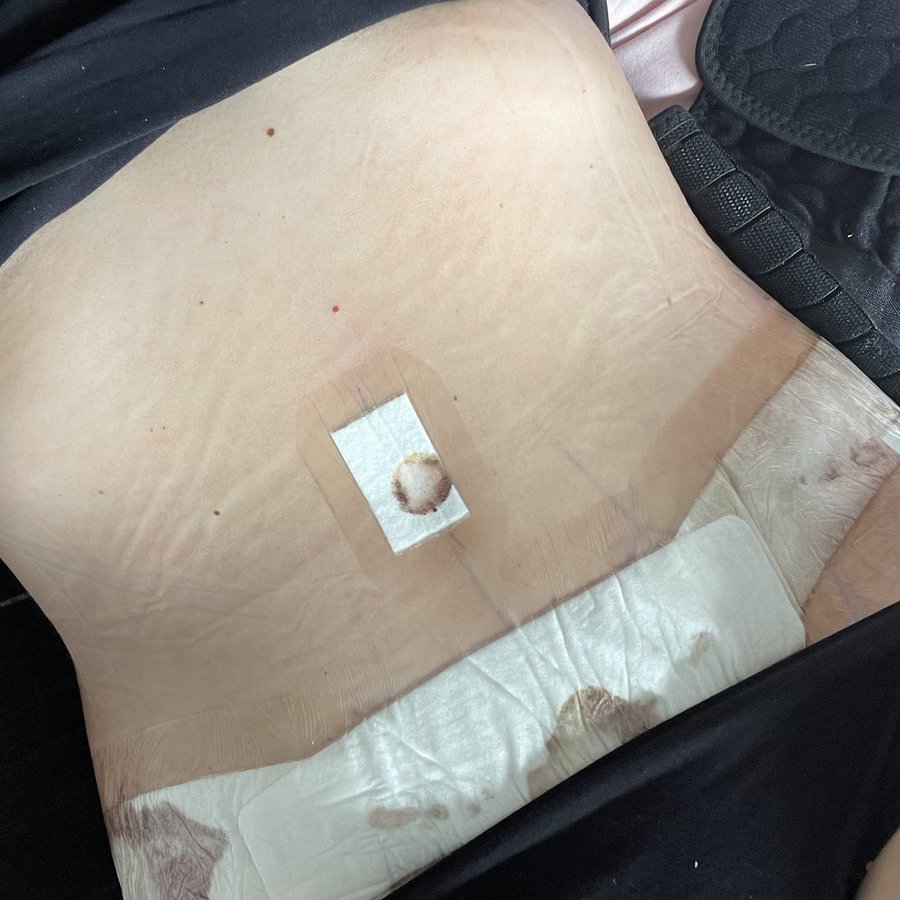 Anthony MacQuillan Cosmetic Surgeon-Bristol - Anthony MacQuillan Cosmetic Surgeon-Bristol