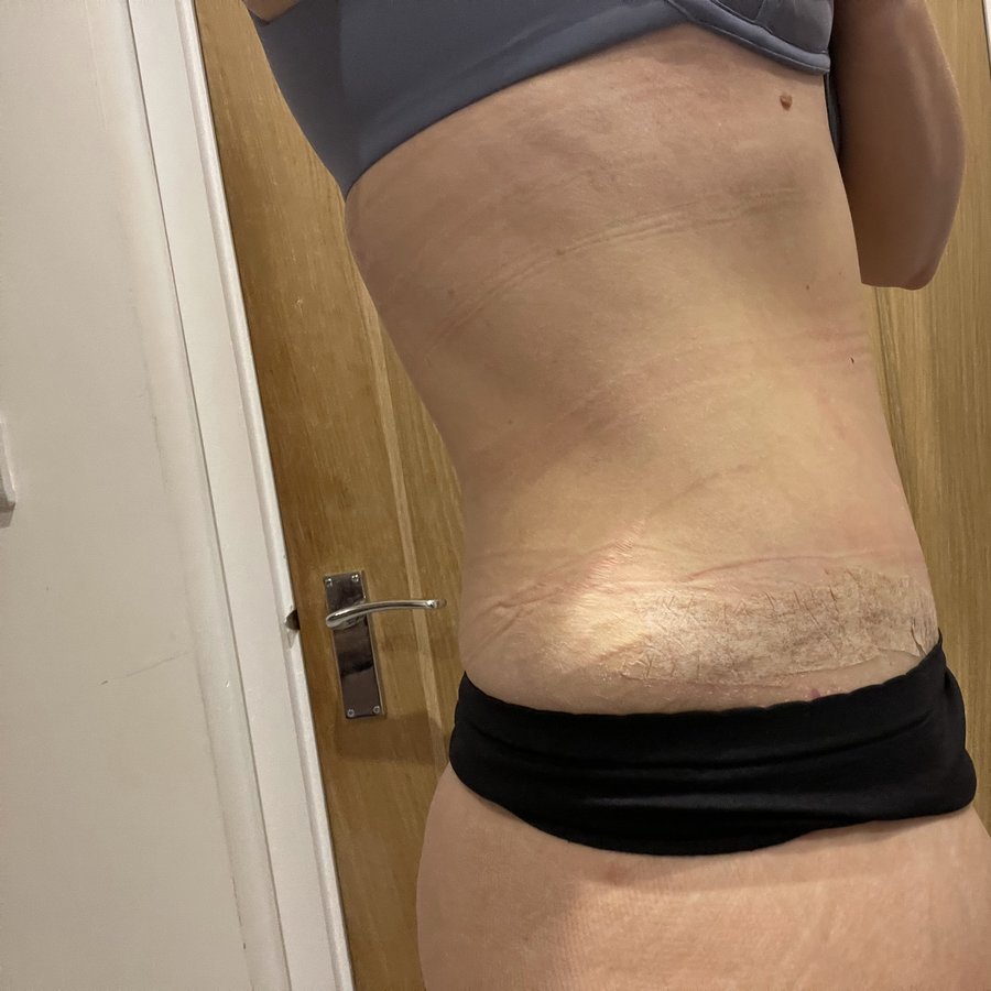 Anthony MacQuillan Cosmetic Surgeon-Bristol - Anthony MacQuillan Cosmetic Surgeon-Bristol