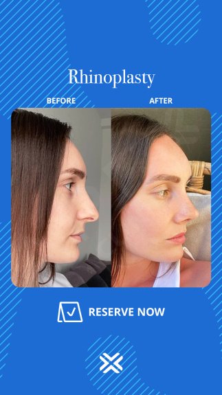 APEX CLINIC - APEX CLINIC