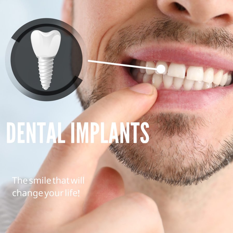 Apexdental - Apexdental