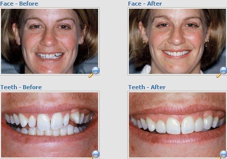 Apurva Dental Care - Apurva Dental Care