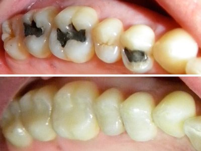 Apurva Dental Care - Apurva Dental Care