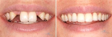 Apurva Dental Care - Apurva Dental Care