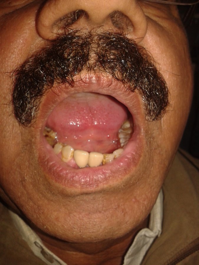 Arora Dental Implant Clinic - Arora Dental Implant Clinic