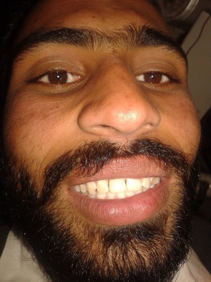 Arora Dental Implant Clinic - Arora Dental Implant Clinic