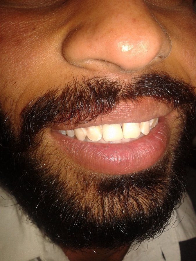 Arora Dental Implant Clinic - Arora Dental Implant Clinic