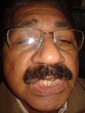 Arora Dental Implant Clinic - Arora Dental Implant Clinic