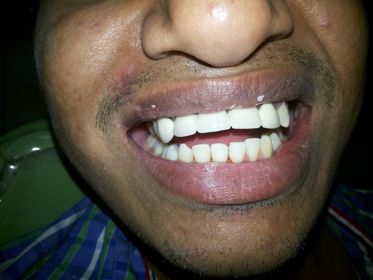 Asansol Dental & Maxillofacial Centre - Asansol Dental & Maxillofacial Centre