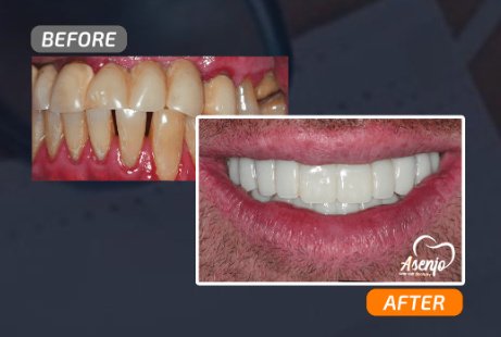 Asenjo One Visit Dentistry - Asenjo One Visit Dentistry