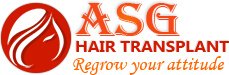 Asg Hair Transplant - Ludhiana - Asg Hair Transplant - Ludhiana