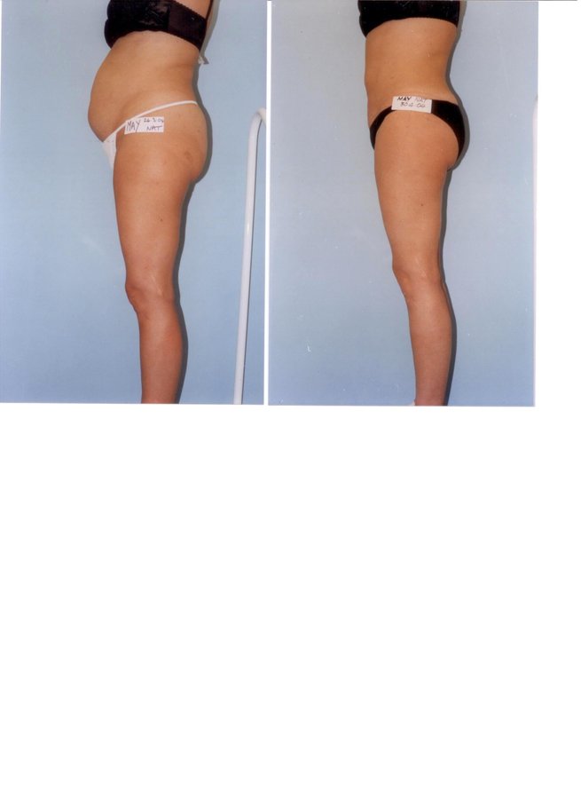 Ashbrooke Cosmetic Surgery - Ashbrooke Cosmetic Surgery