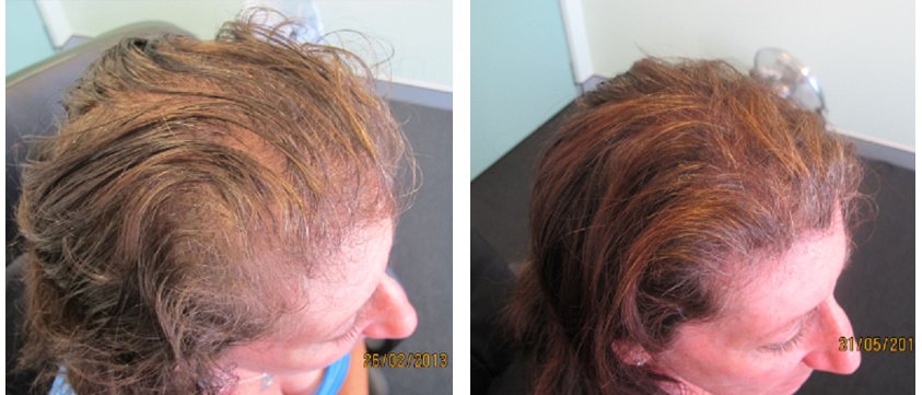 Ashley and Martin Hair Loss Centre - Singapore - Ashley and Martin Hair Loss Centre - Singapore