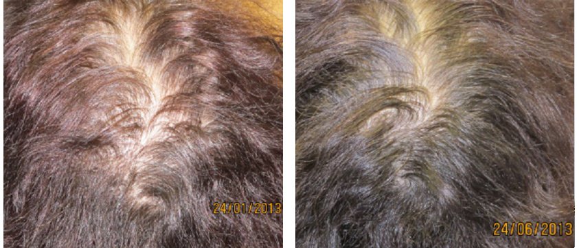 Ashley and Martin Hair Loss Centre - Singapore - Ashley and Martin Hair Loss Centre - Singapore