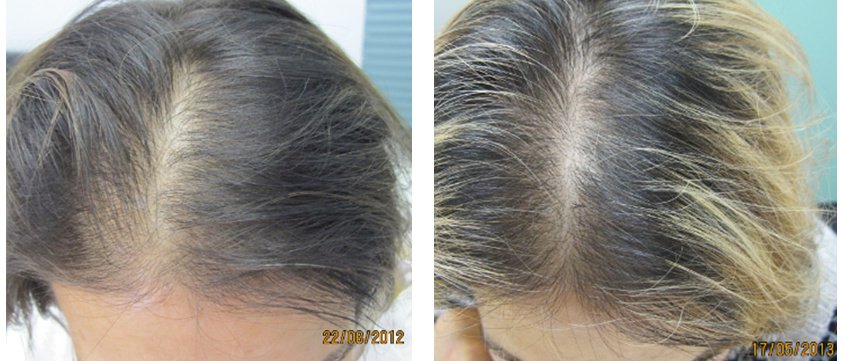 Ashley and Martin Hair Loss Centre - Singapore - Ashley and Martin Hair Loss Centre - Singapore